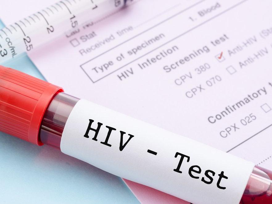 ABD'de 3 binden fazla hastaya HIV veya hepatit bulaşmış olabilir