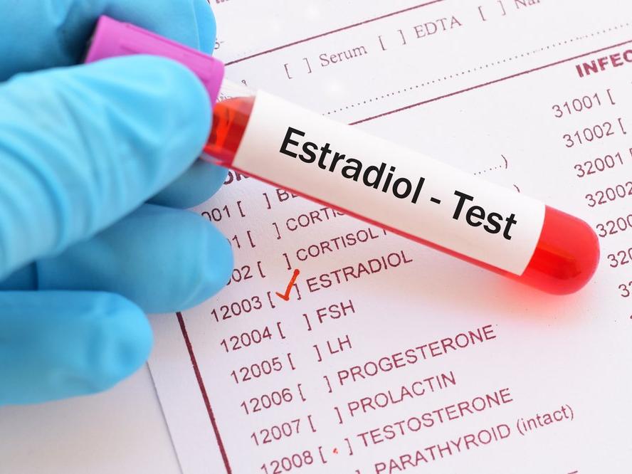 E2: Estradiol nedir? Estradiol yüksekliği ve düşüklüğü ne anlama gelir?