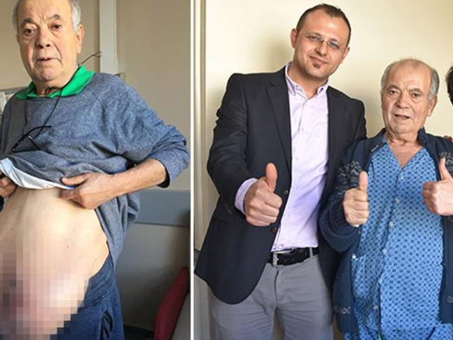Fransa'da 'riskli' diye ameliyatı yapılmadı, Adana'da sağlığına kavuştu