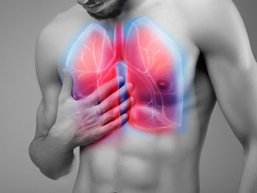 Akciğer ödemi (pulmoner ödem) nedir? Akciğer ödemi nedenleri, belirtileri ve tedavisi...