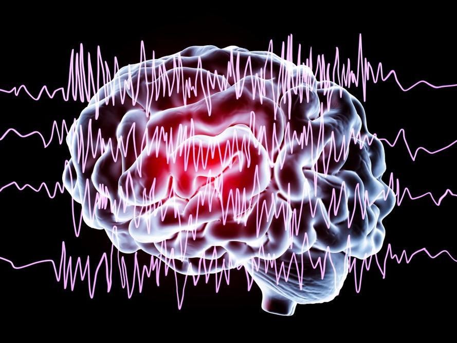 'Derin beyin stimülasyonu' epilepsi tedavisinde umut olacak