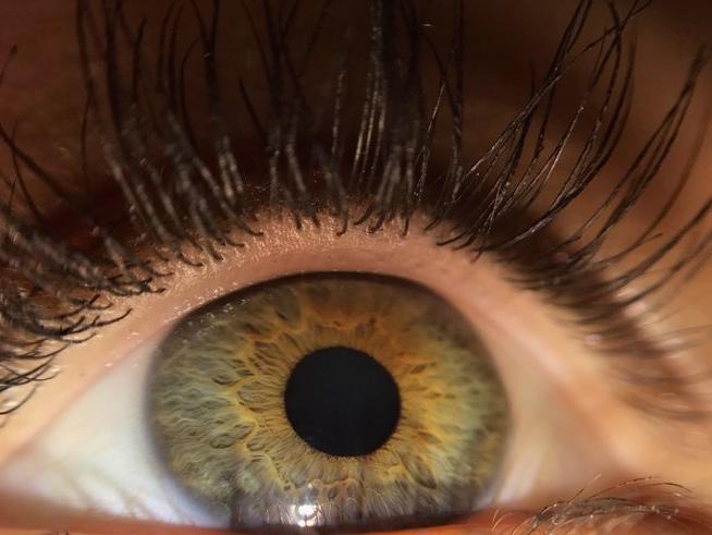 Göz iltihabı nedir? Göz iltihabı nedenleri, belirtileri ve tedavisi...