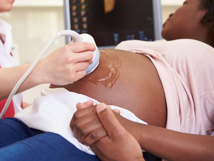 ABD'de ırkçılık siyahi anne-bebeklerin hayatını tehdit ediyor
