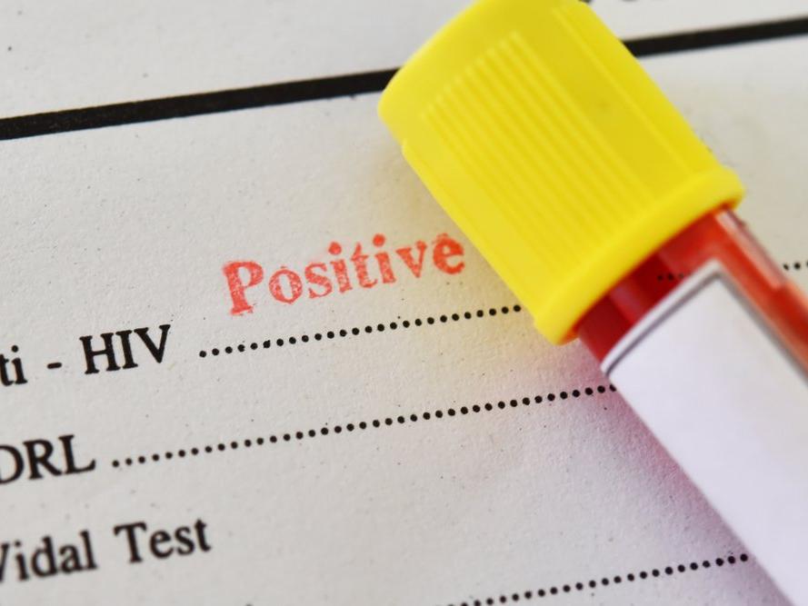 Dünyada ikinci vaka: HIV pozitiften tamamen kurtuldu