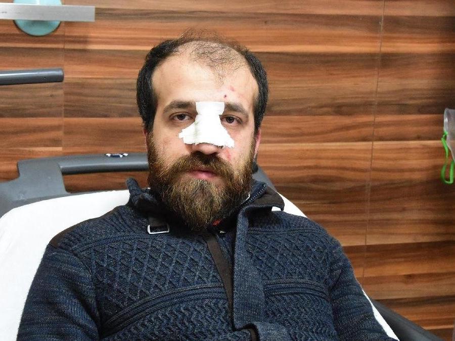 Sağlık Bakanı Fahrettin Koca: Olayın failleri tutuklanmıştır