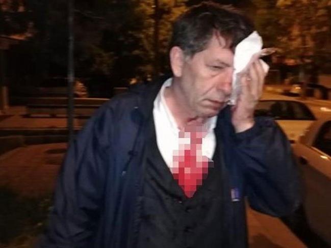 Gazeteci Demirağ'a saldırının araştırılması Meclis'te reddedildi