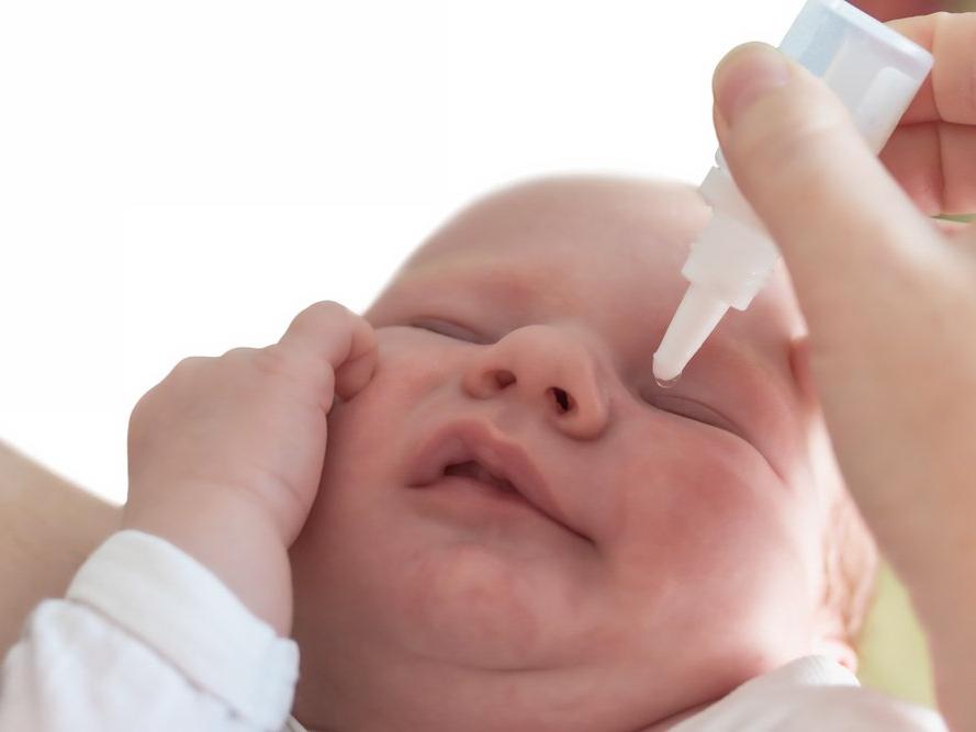 Bebeklerde göz çapaklanmasına anne sütü iyi gelir mi?