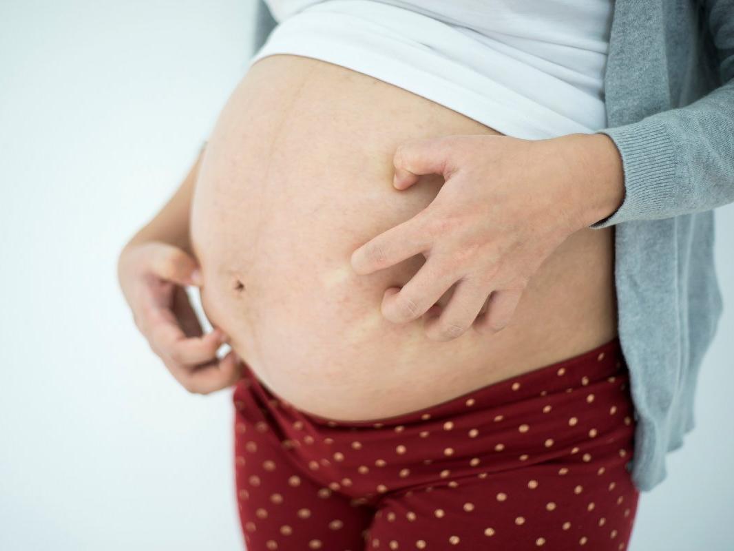Hamilelikte kaşıntı neden olur? Kaşıntı tedavisi...