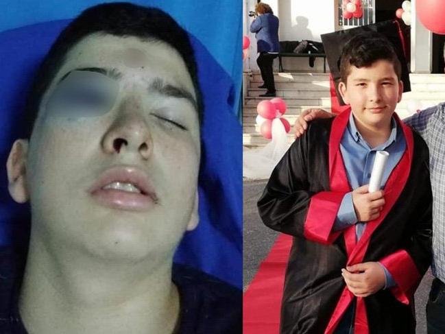 Maganda kurşunu! 15 yaşındaki Burak gözünden ağır yaralandı