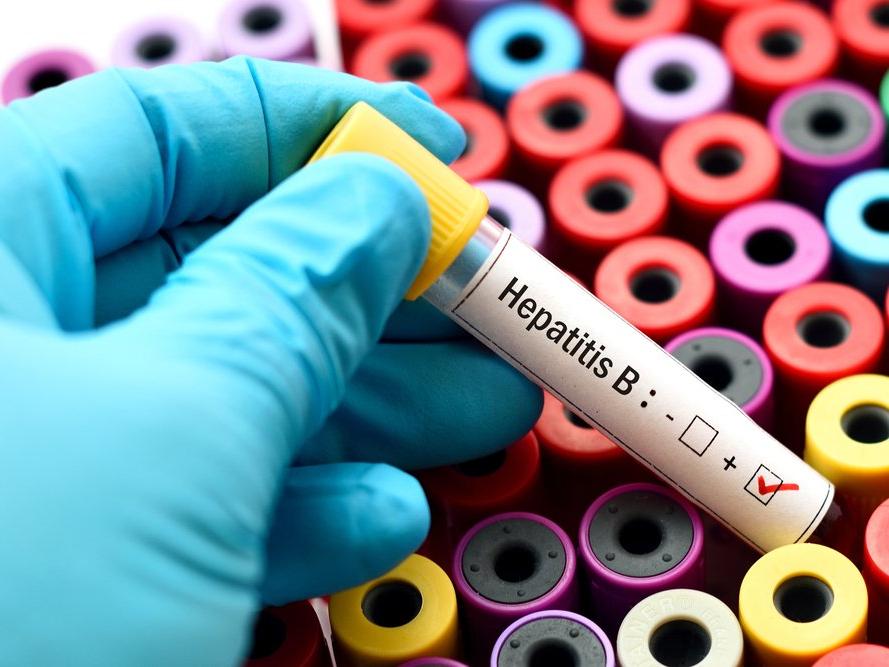 Viral hepatitle savaşta kilit nokta: Tanı ve tedavi