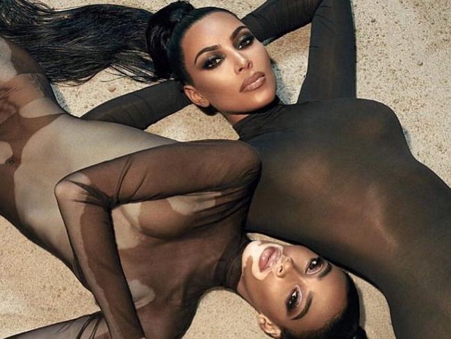 Kim Kardashian kozmetik markası için Winnie Harlow ile işbirliği yaptı