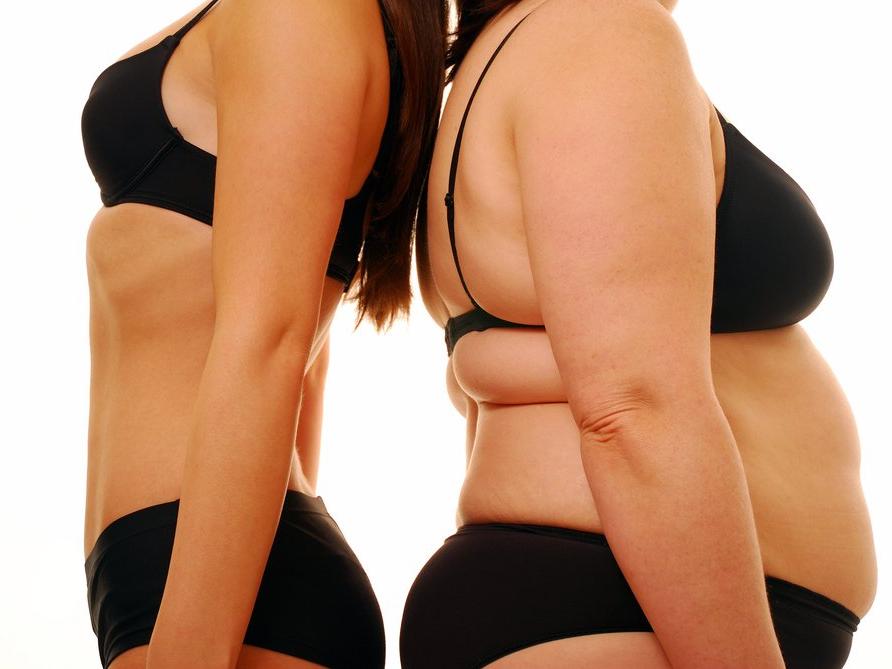 'Beyaz ve kilolu kadınlar esmer kadınlara göre 2 kat daha risk altında'