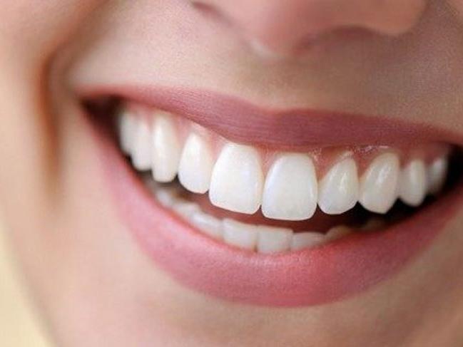 Diş minesi nedir? Diş minesi aşınması nasıl geçer?