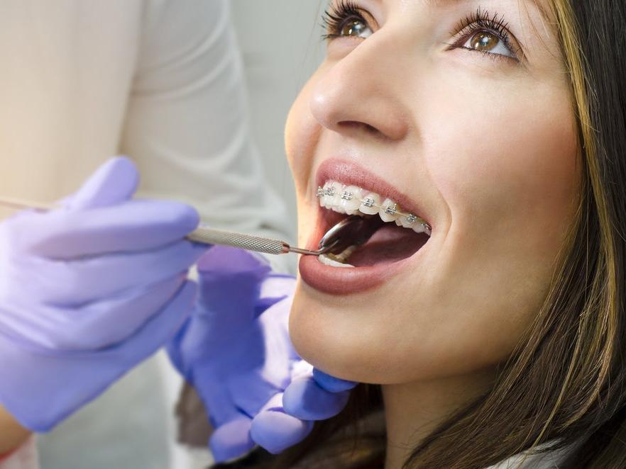 Ortodonti nedir? Hangi hastalıklara bakar?