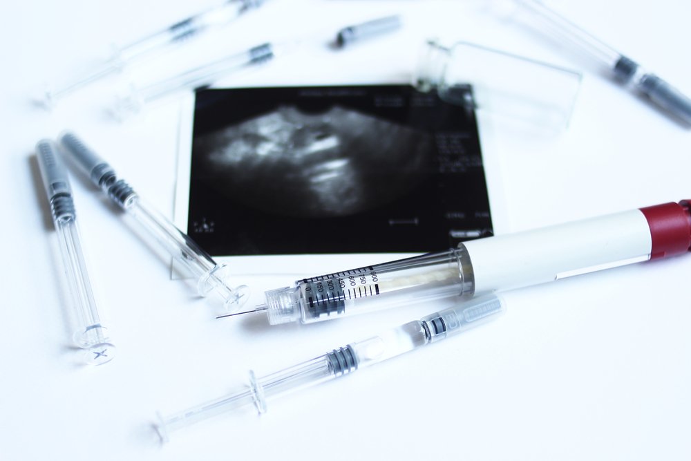 Tüp bebek gebelik testi değerleri kaç olmalıdır?