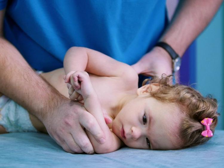 Serebral palsi bebeklerde nasıl anlaşılır?