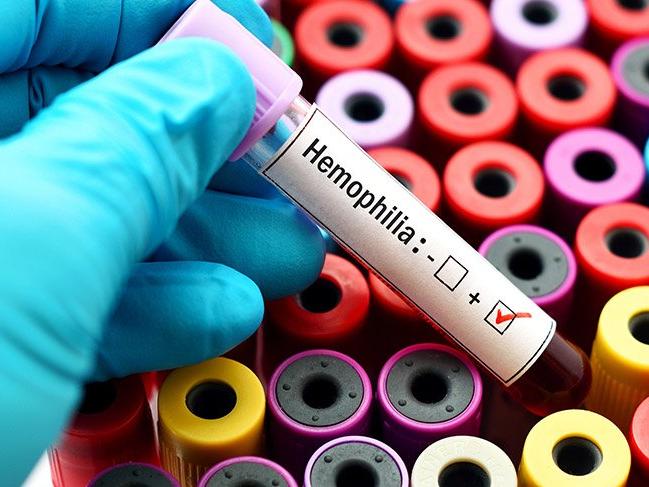 Hemofili A hastalığının sağlık harcamalarındaki payı yıllık 3 milyar TL