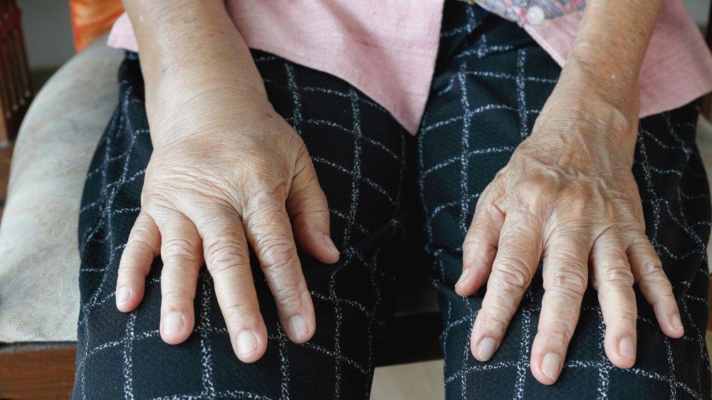 Albümin nedir? Düşüklüğü ne anlama gelir?