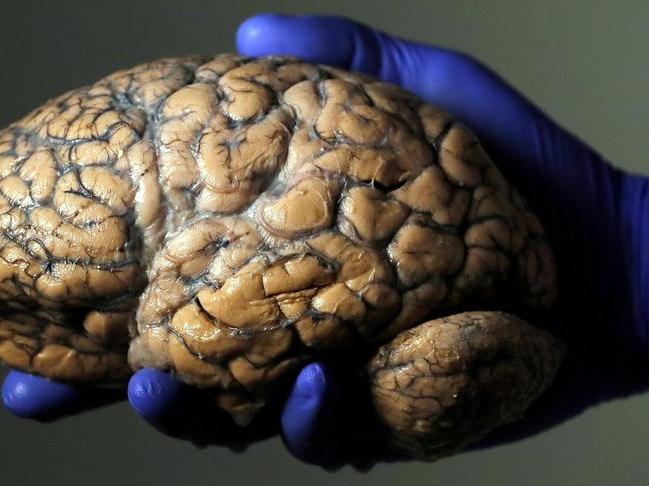 Bilim insanları, beynin yaşlanmasını yavaşlatmanın yolunu buldu