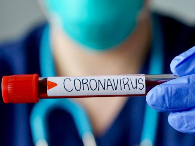 Singapur'da Corona virüsü alarmı SARS seviyesinde!