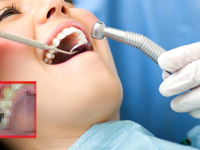 Kadın hastanın diş etlerinden çıkanlar doktorları bile şaşırttı!