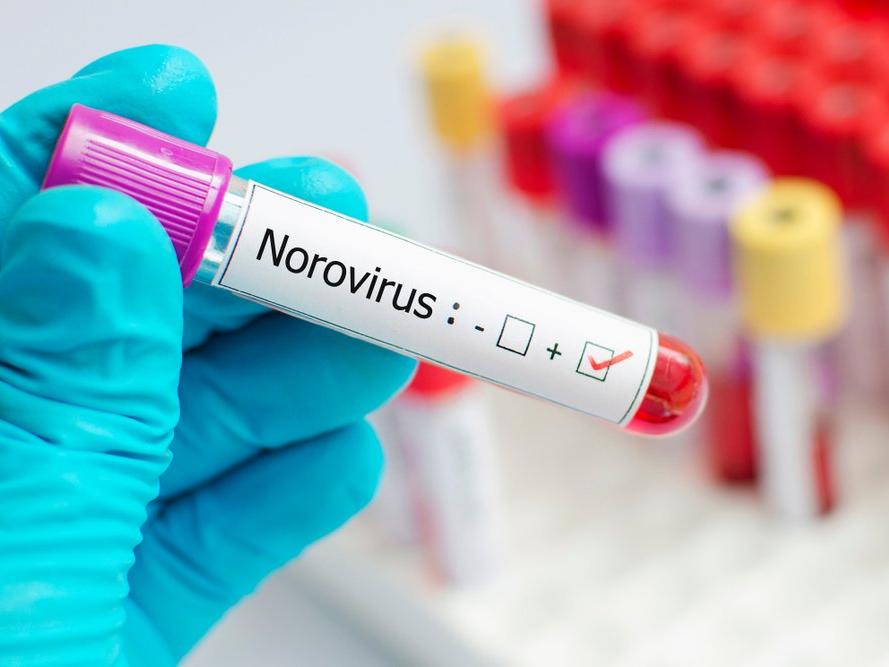 Norovirüs enfeksiyonu nedir? Belirtileri ve tedavisi...