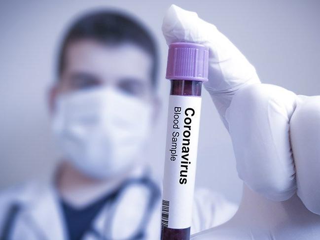 Koronavirüs 4 ülkeye daha sıçradı
