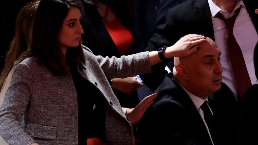 Erdoğan'dan, Özkoç'a 1 milyon liralık tazminat davası