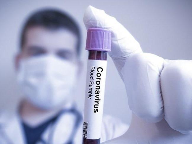 KKTC'de corona virüsü tespit edilenlerin sayısı 5'e yükseldi