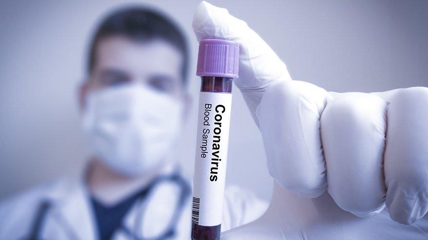 Corona virüs belirtileri neler? Corona virüsünün yeni belirtileri ortaya çıktı…