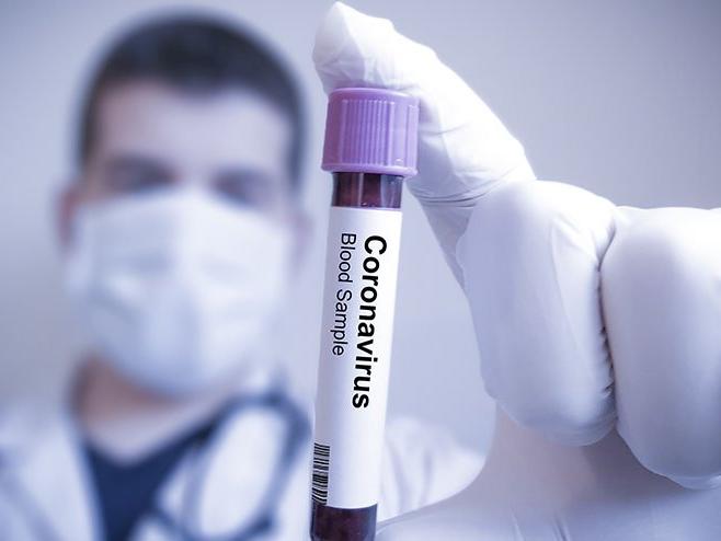 Corona virüs belirtileri neler? Corona virüsünün yeni belirtileri ortaya çıktı…