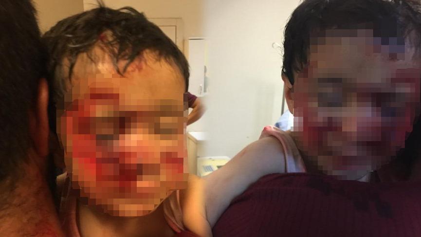 Köpek saldırısına uğrayan küçük Davut, kurtarılamadı