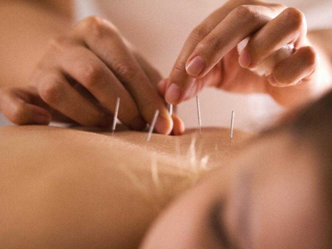 Akupunktur tedavisi orucu bozar mı?