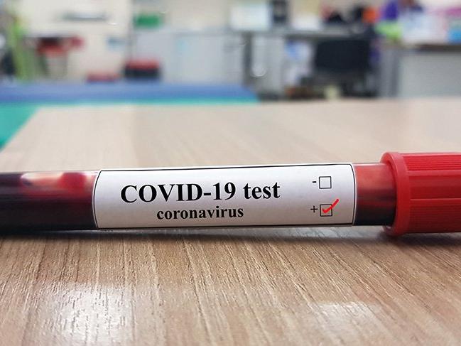 Balıkesir'de corona virüsü test sayısı 10 bini aştı