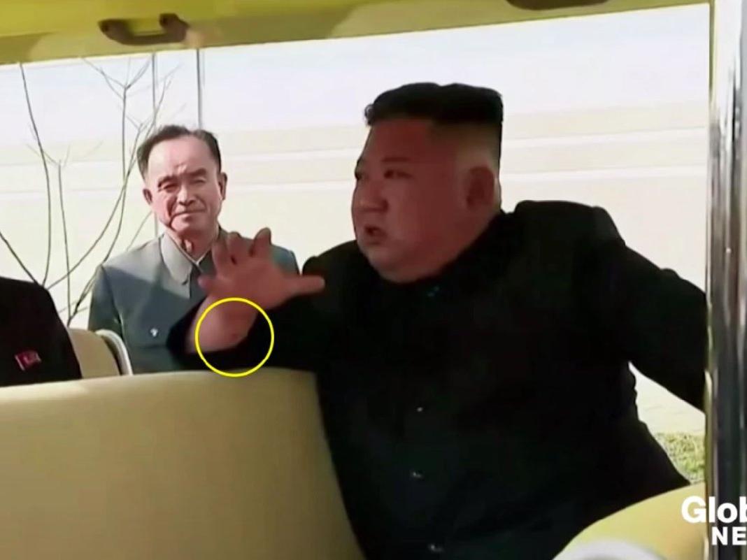 Haftalar sonra ortaya çıkan Kim Jong-un'un fotoğrafındaki şoke eden detay