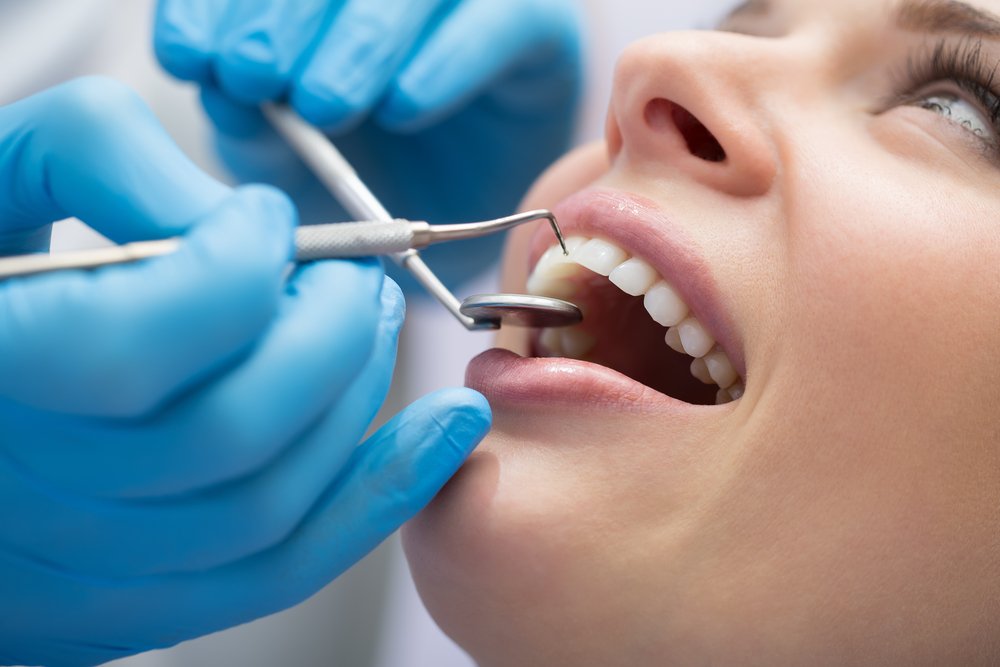 Diş minesi çatlaması için ne yapılabilir? Diş çatlağı tedavisi nasıl olur?