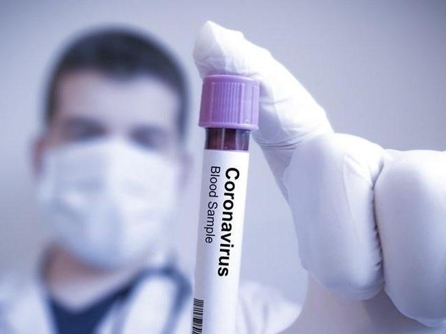 Oxford Üniversitesi açıkladı: Corona aşısı Afrika'da denenecek!