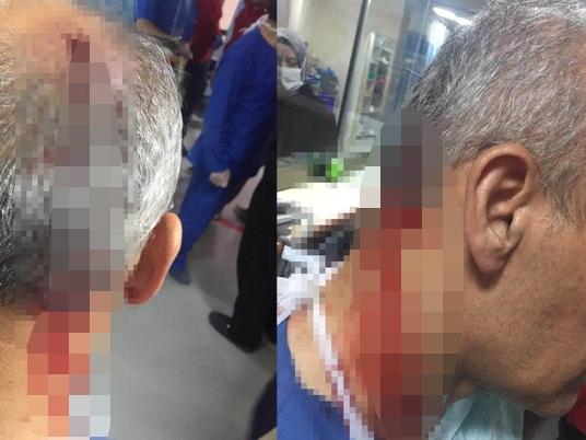 Elazığ'da doktora yumruklu saldırı