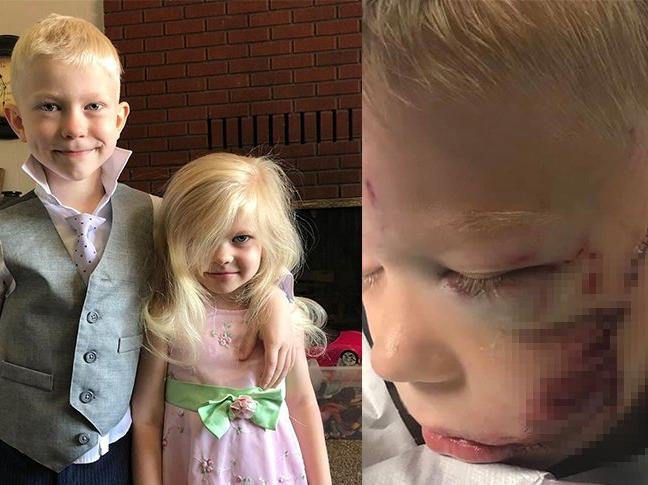 Kız kardeşini köpek saldırısından kurtaran 6 yaşındaki çocuk, sosyal medyanın yeni kahramanı oldu
