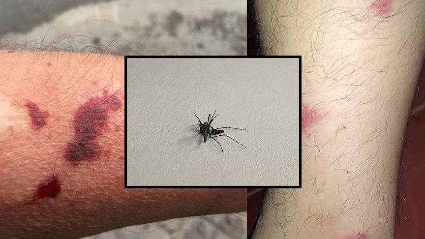 Sapanca'da 'Asya Kaplanı' paniği... Yardım istediler