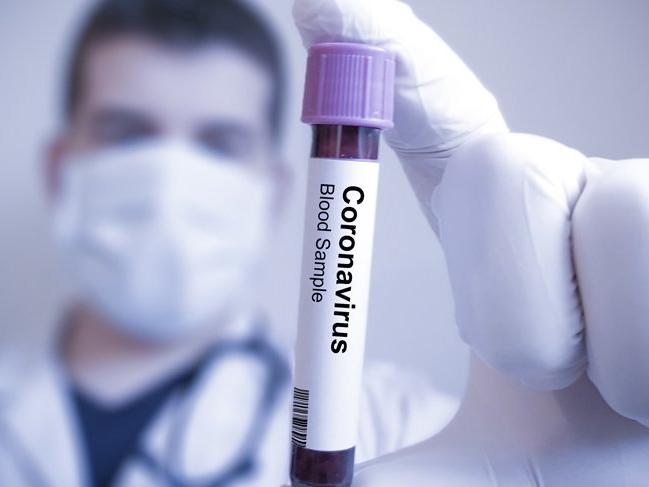 24 hastanın 23'ünde doğru tahmin! Corona hastaları için yeni kan testi geliştirildi