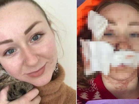 Ukraynalı kadına falçatalı saldırı yapan kocası tutuklandı