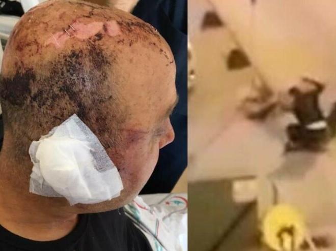 Telsizle dövülen polis memuru: Gözlerimi hastanede açtım