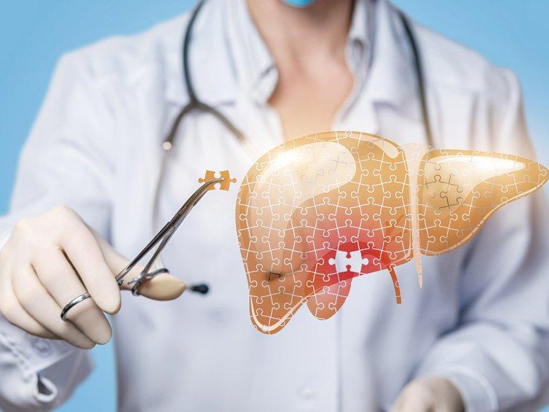 Karaciğer yağlanması nasıl önlenir?