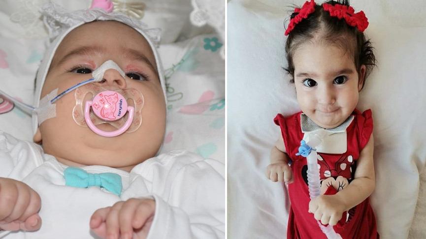 SMA hastası Elif bebek hayatını kaybetti