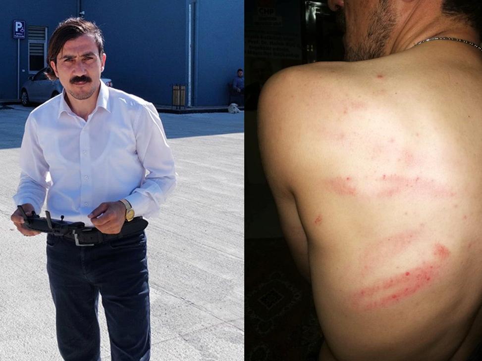 Hastanenin eksiklerini haber yapan gazeteciyi dövdüler