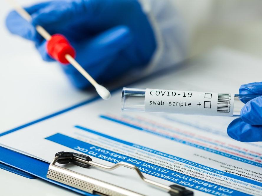 Ukrayna'dan mutasyona karşı 4 ülkeye PCR testi şartı