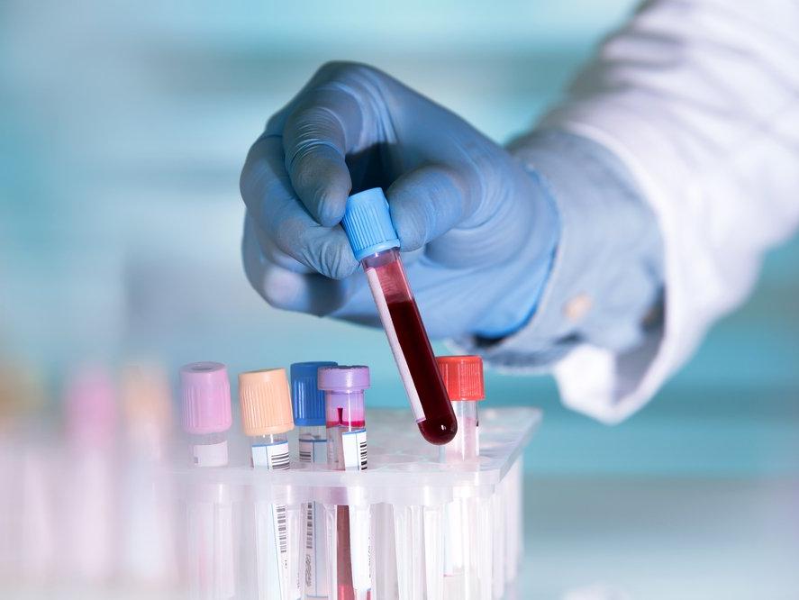 50 kanser türünü teşhis edebilen kan testi geliştirdiler