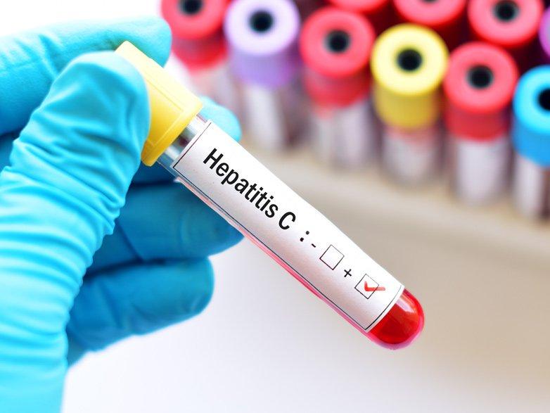 Pandemide Hepatit C’ye dikkat