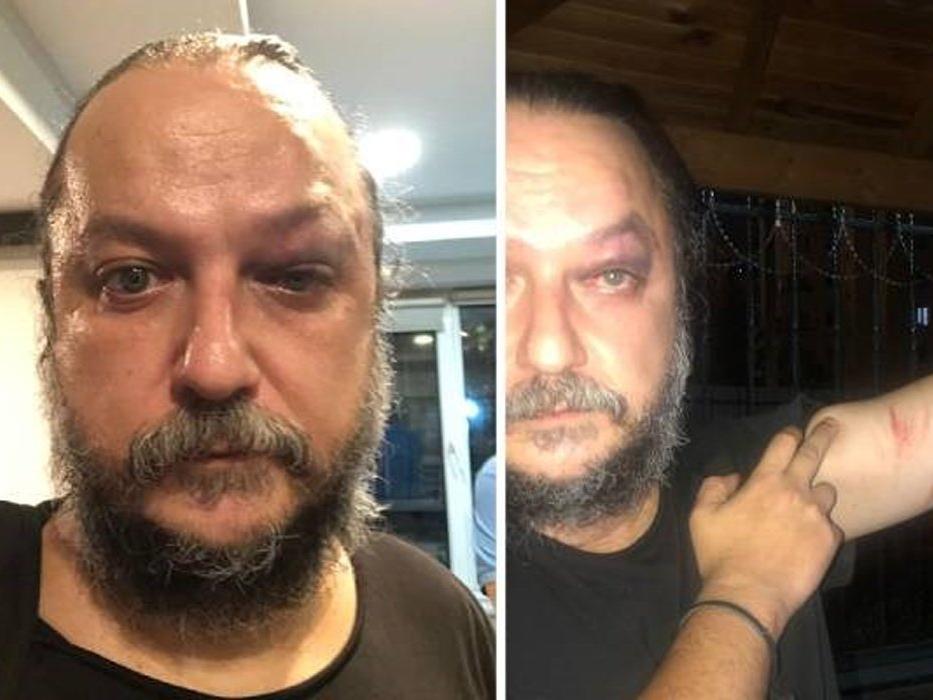 Opera sanatçısı 30 Ağustos konseri sonrası saldırıya uğradı